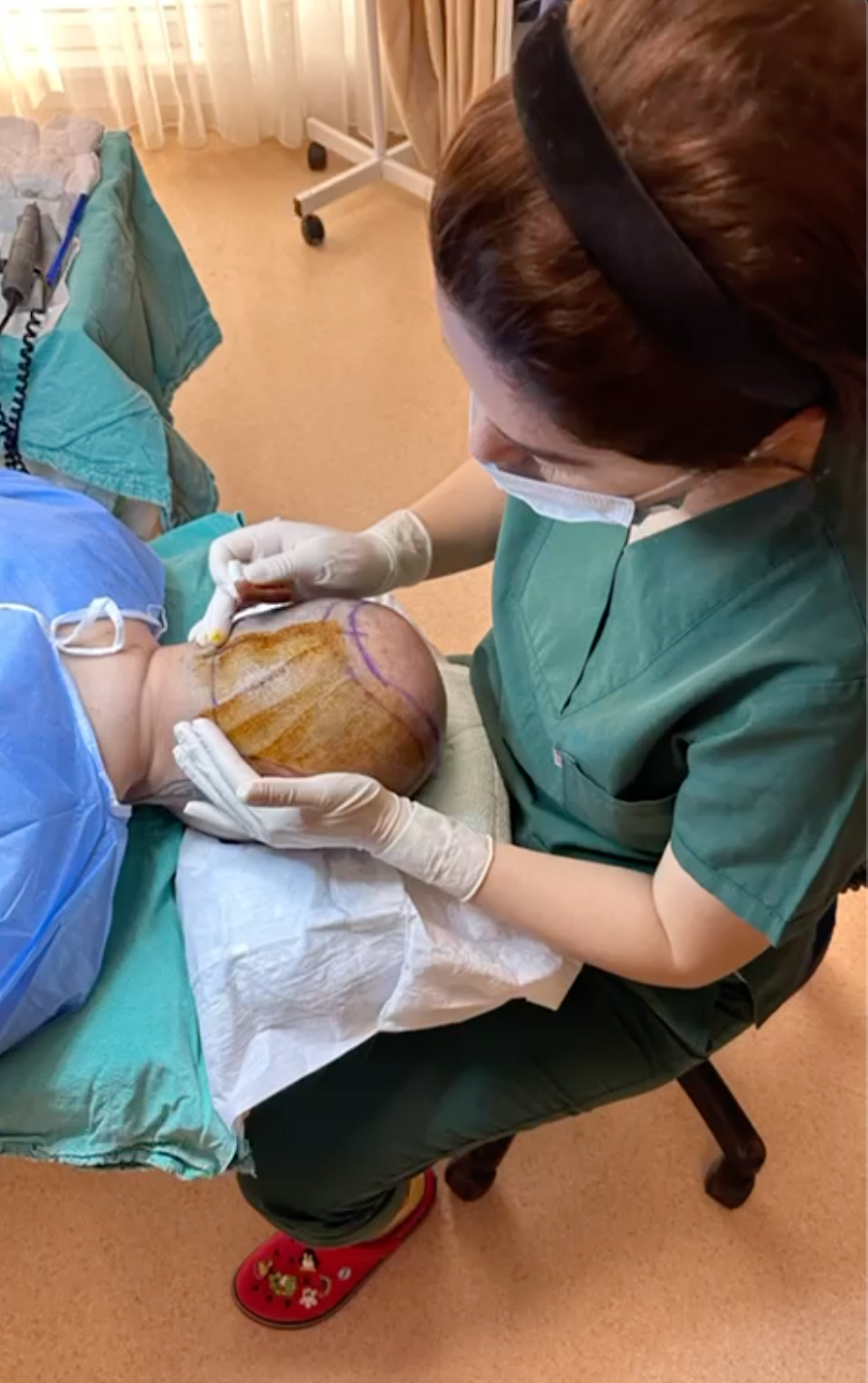 Recovery Tips After Hair Implantation